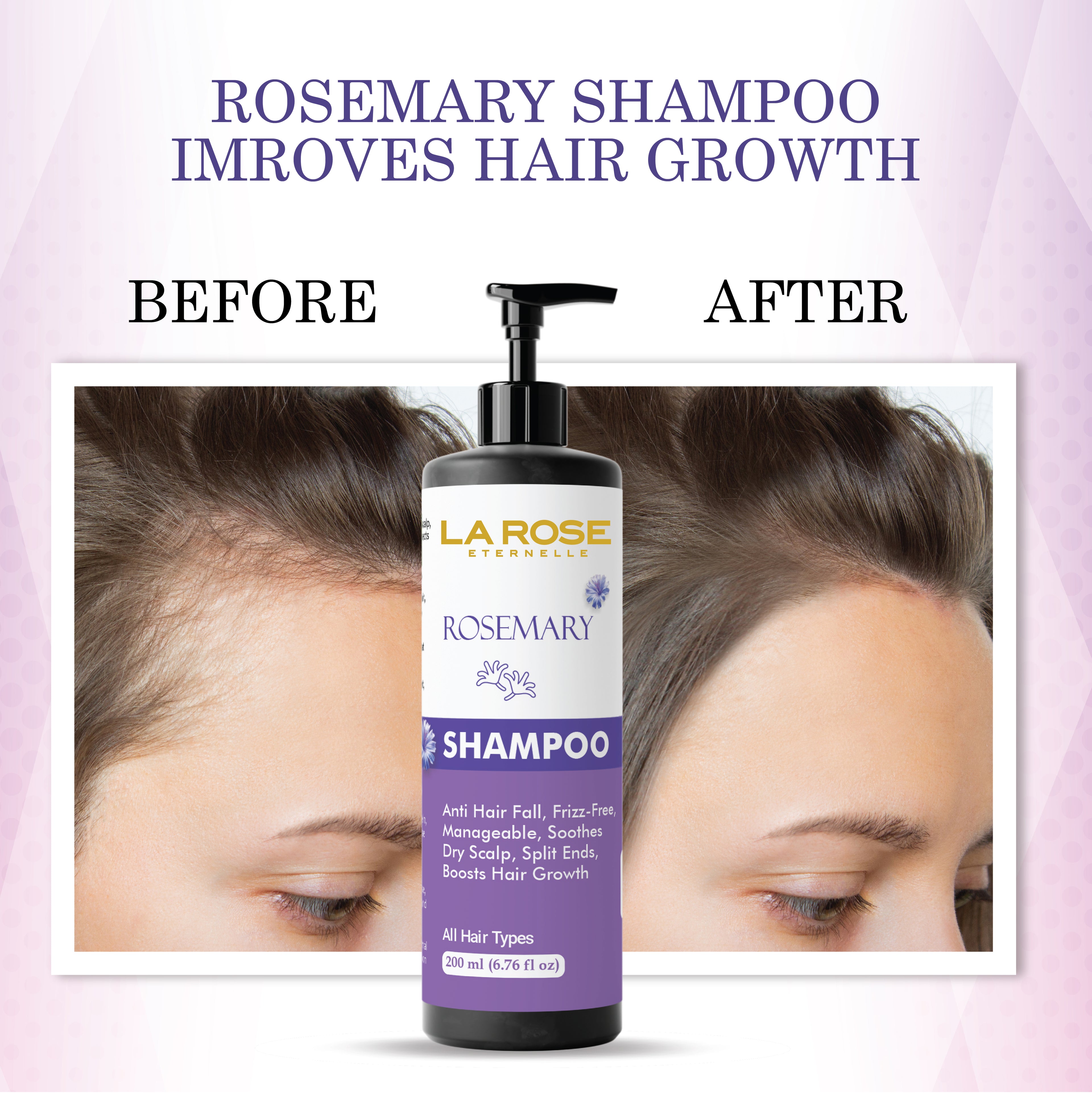 La Rose Eternelle Rosemary Shampoo, Anti Hair Fall, Frizz-Free, Split Ends Treatment, All Hair Types, 200ml